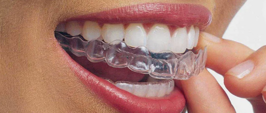 Invisalign vs. Braces: Which Is Better for Your Smile Journey?