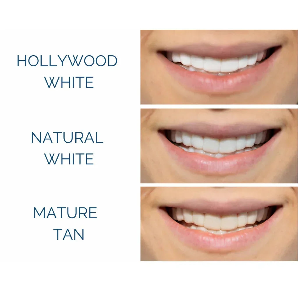 Why Teeth Can Look Dull After Whitening