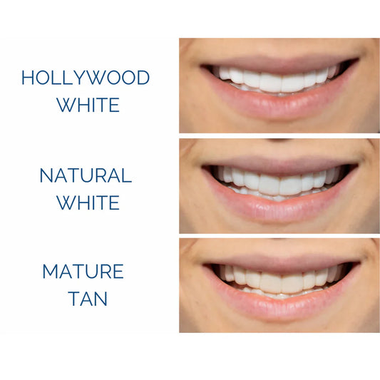 The "Chalky" Smile: Why Your Whitened Teeth Look Cheap—and How to Restore Their Natural Glow