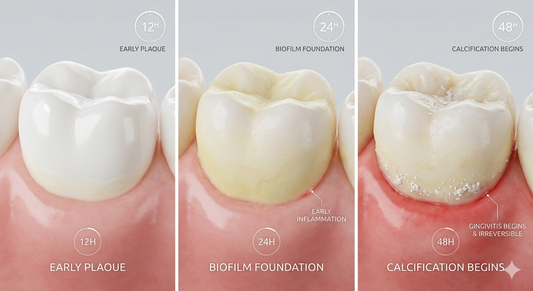 A Terrifying Truth: Tartar Begins Forming After Just 48 Hours Without Brushing!